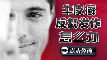 银屑病秋季复发前兆是什么