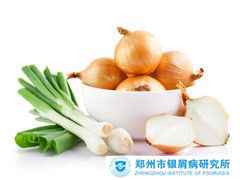 牛皮癣患者的饮食方面注意