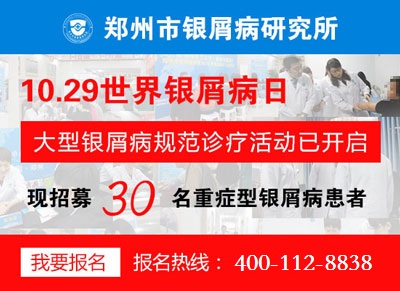 倒计时!世界银屑病日大型会诊活动 仅限10.29