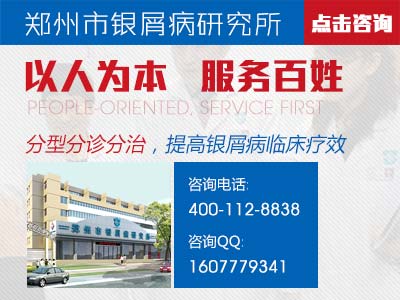 牛皮癣会传染吗