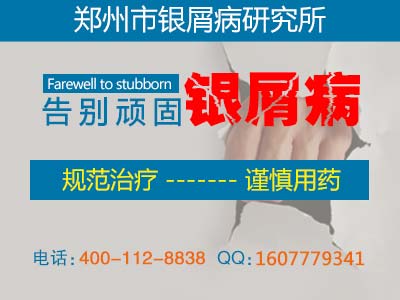 患上牛皮癣的孕妇要日常护理有哪些