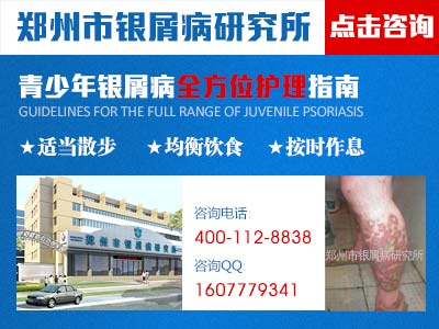 成人牛皮癣该怎么护理才好