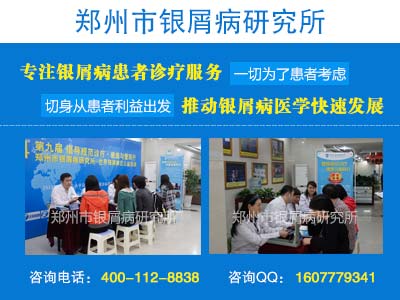 哪些是导致牛皮癣的原因