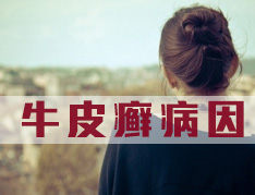 诱发牛皮癣的具体因素有哪些呢?