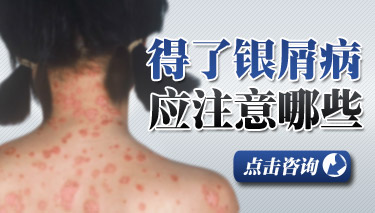 头部牛皮癣应该如何调理