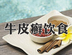 牛皮癣饮食原则是怎样的?
