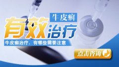 对牛皮癣治疗的错误认识有哪些