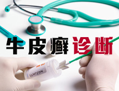 牛皮癣的诊断依据是什么?