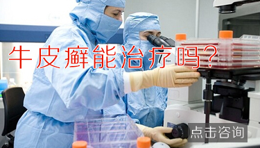 牛皮癣 病人的症状有那些