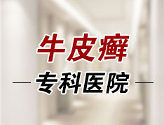 郑州银屑病研究所联系电话